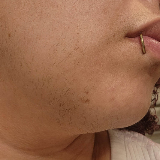 10 maneiras seguras de lidar com os pelos do queixo da SOP