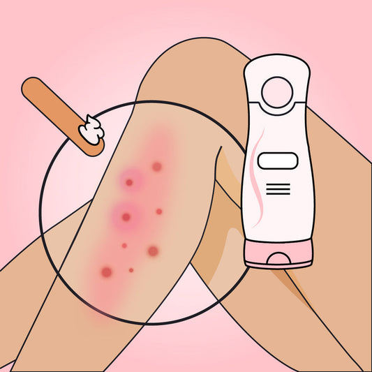 5 Desvantagens do Creme Depilatório