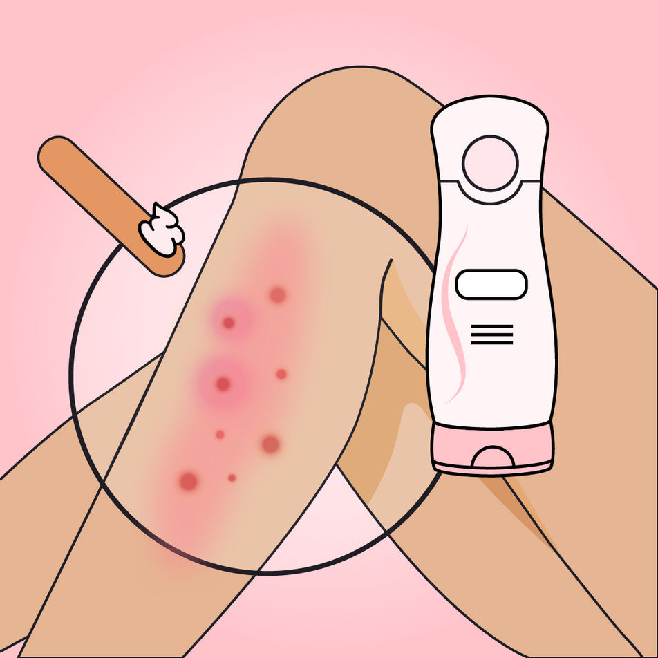 5 Desvantagens do Creme Depilatório