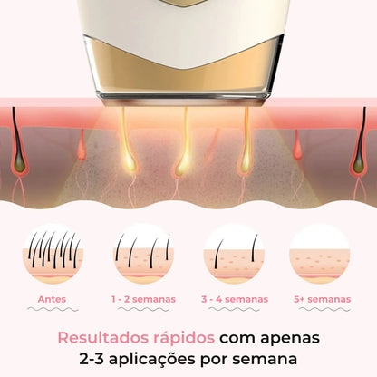 Taqcare IPL Pro™